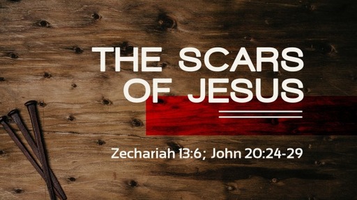 The Scars Of Jesus