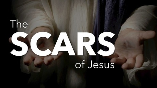 The Scars of Jesus